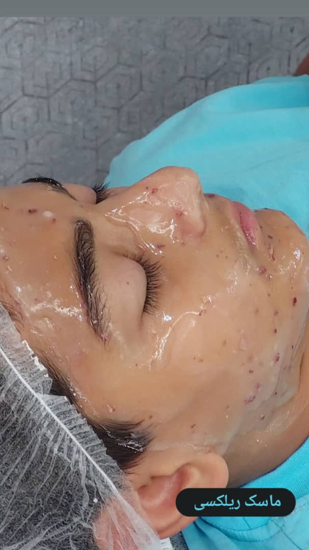 خدمات پاکسازی و درمان پوست یلدا اکبری در شیراز